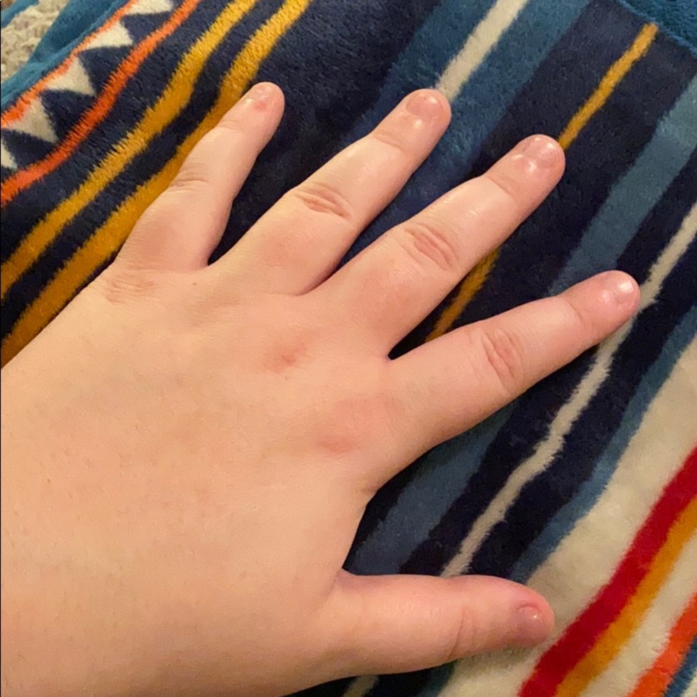 These hands - Picture 2 of 4